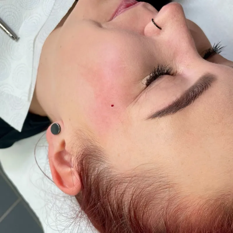 Microdermal — detail šperku