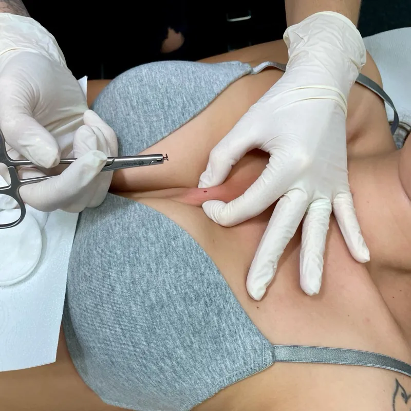 Microdermální šperk — profesionální provedení