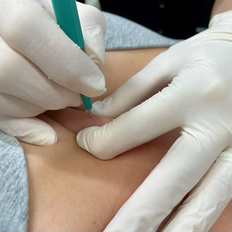 Microdermal piercing ve Viper Studiu