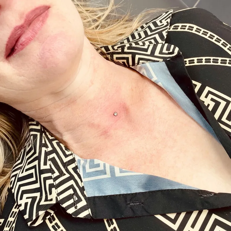 Microdermal — detail šperku