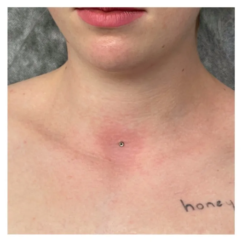 Microdermal — detail šperku