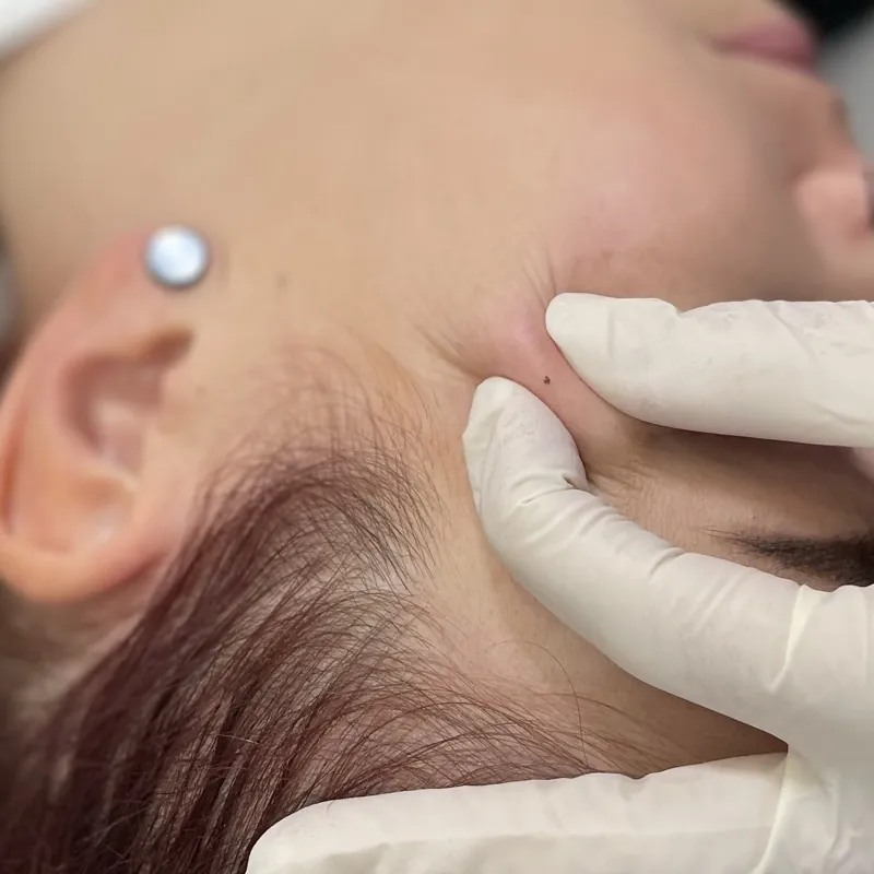 Microdermal — detail šperku