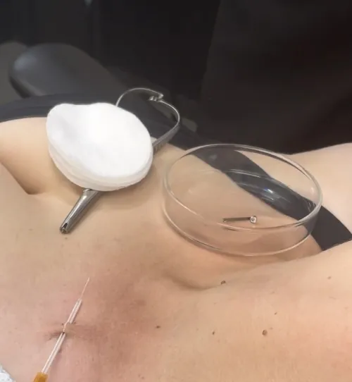 Surface piercing — výsledek