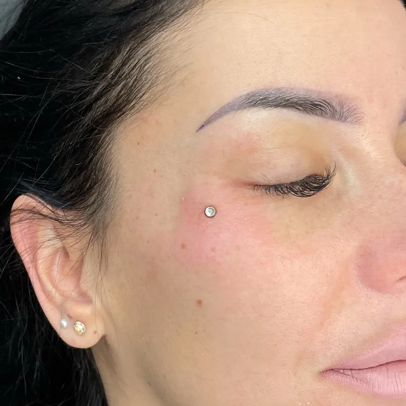 Microdermální piercing — ukázka