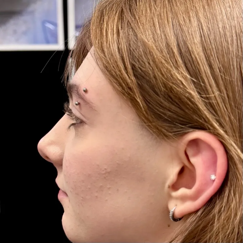 Piercing — zákrok ve sterilním prostředí