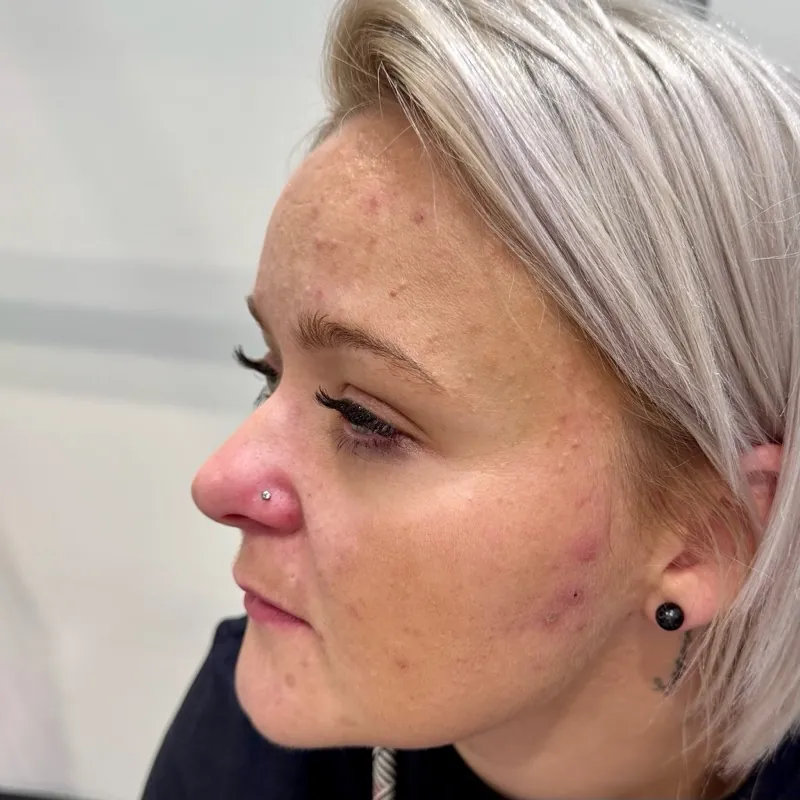 Piercing — spokojená klientka