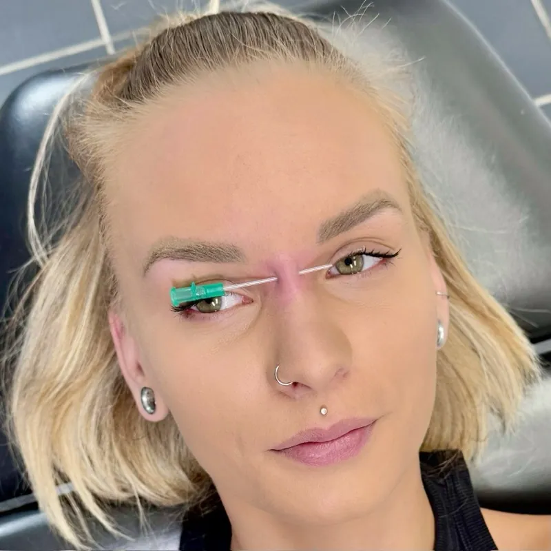 Piercing — výsledek zákroku