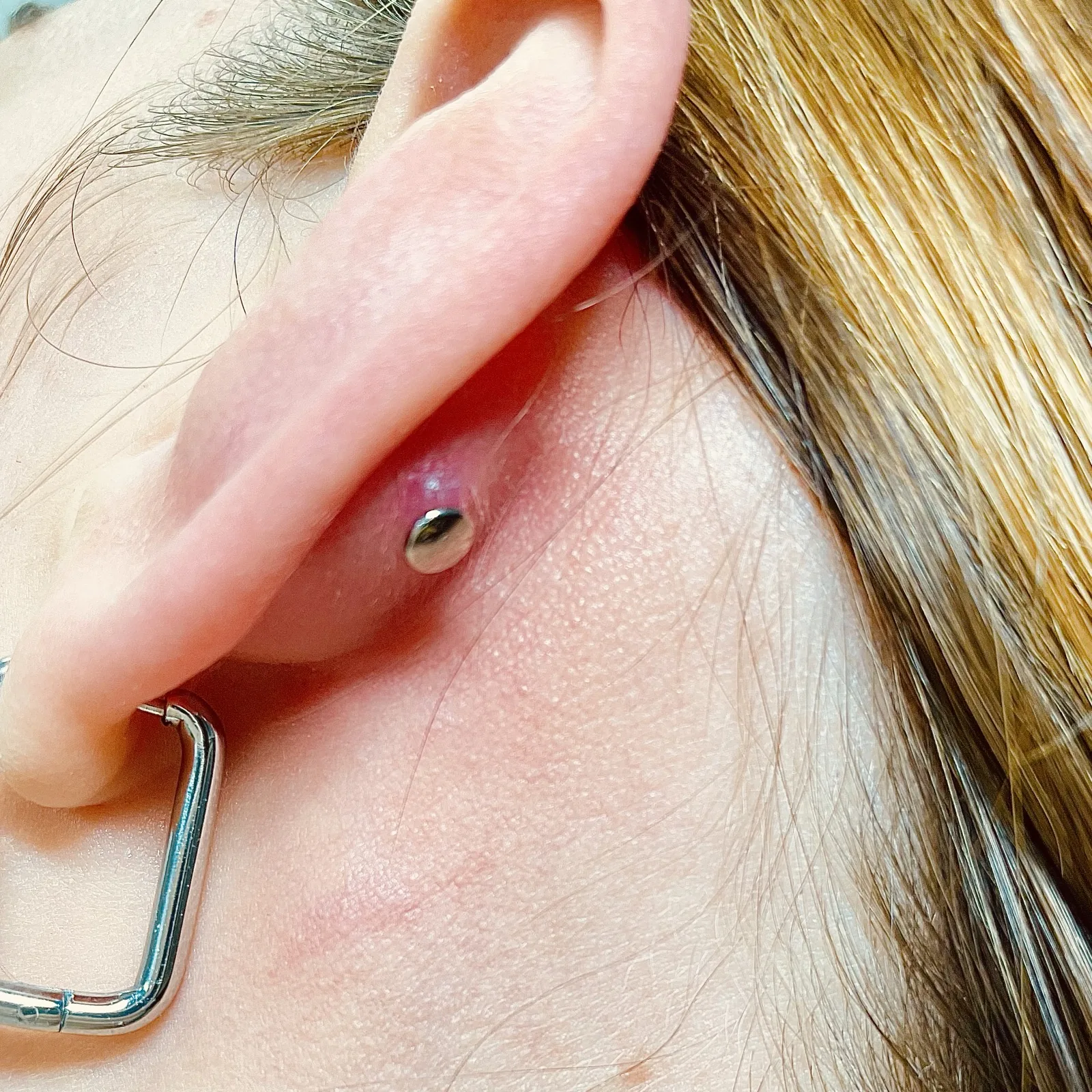Konzultace problematického piercingu