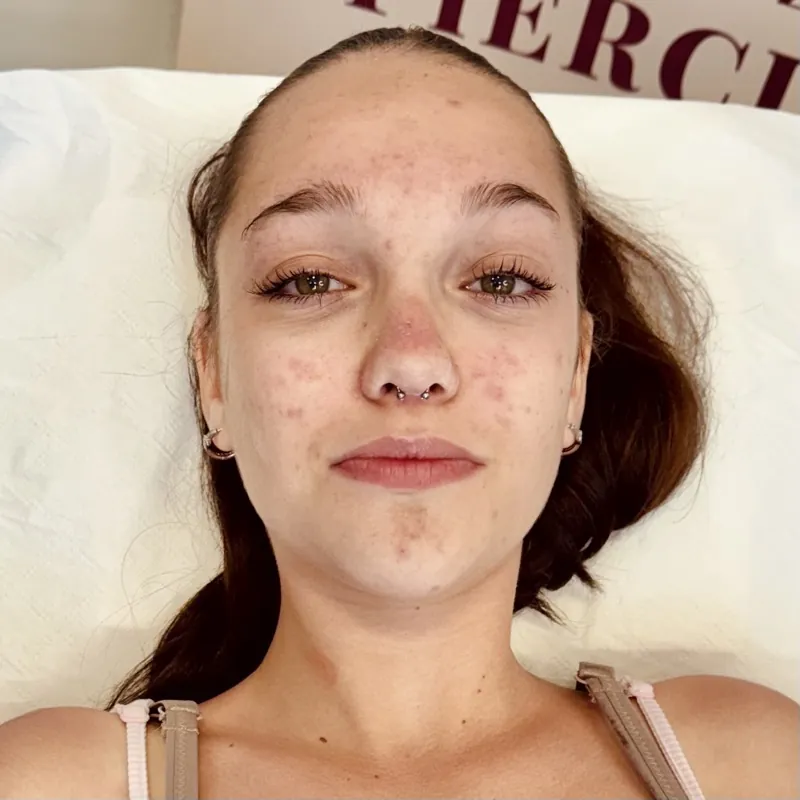 Piercing školení Teplice — Viper Studio