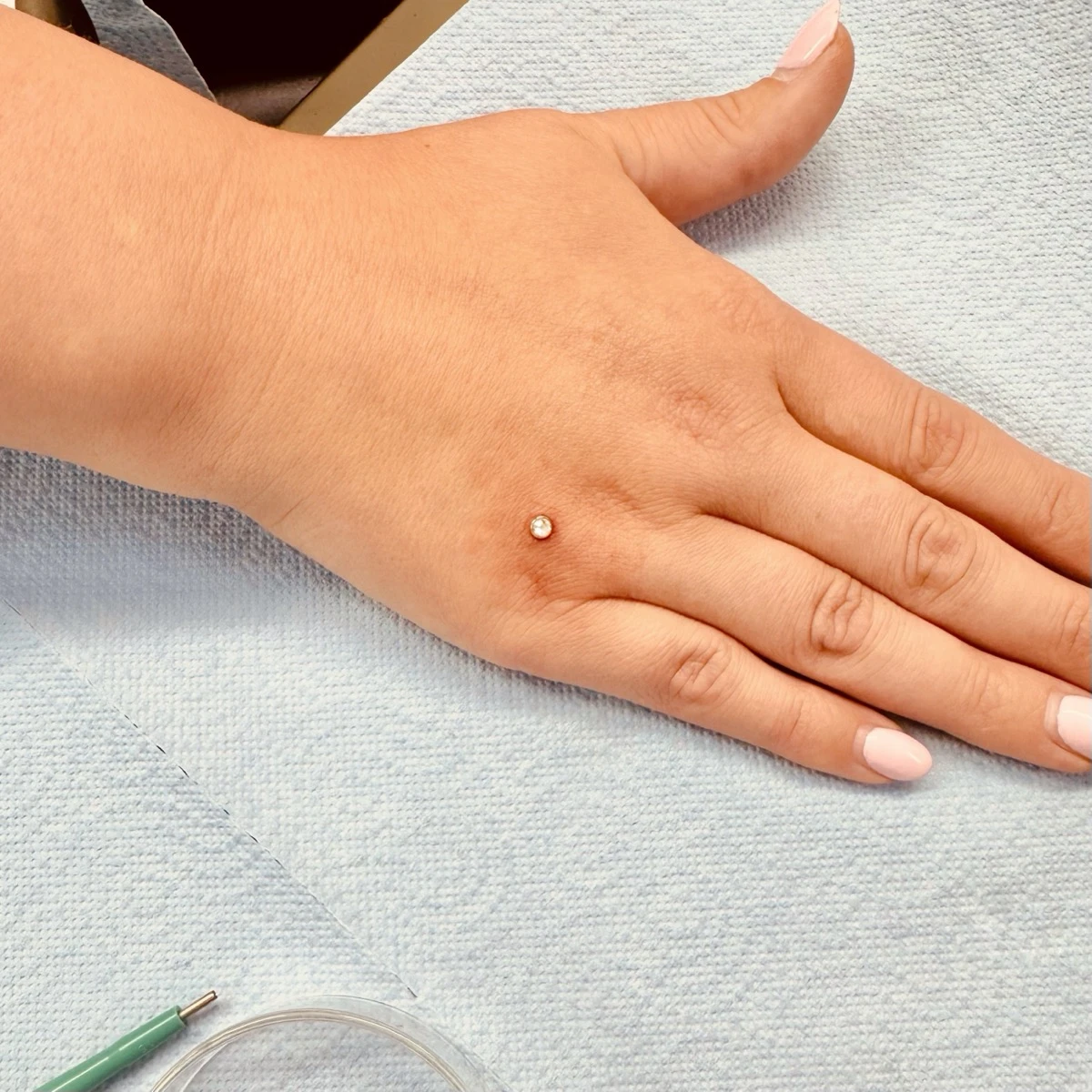 Microdermální šperk na ruce — diskrétní kamínek