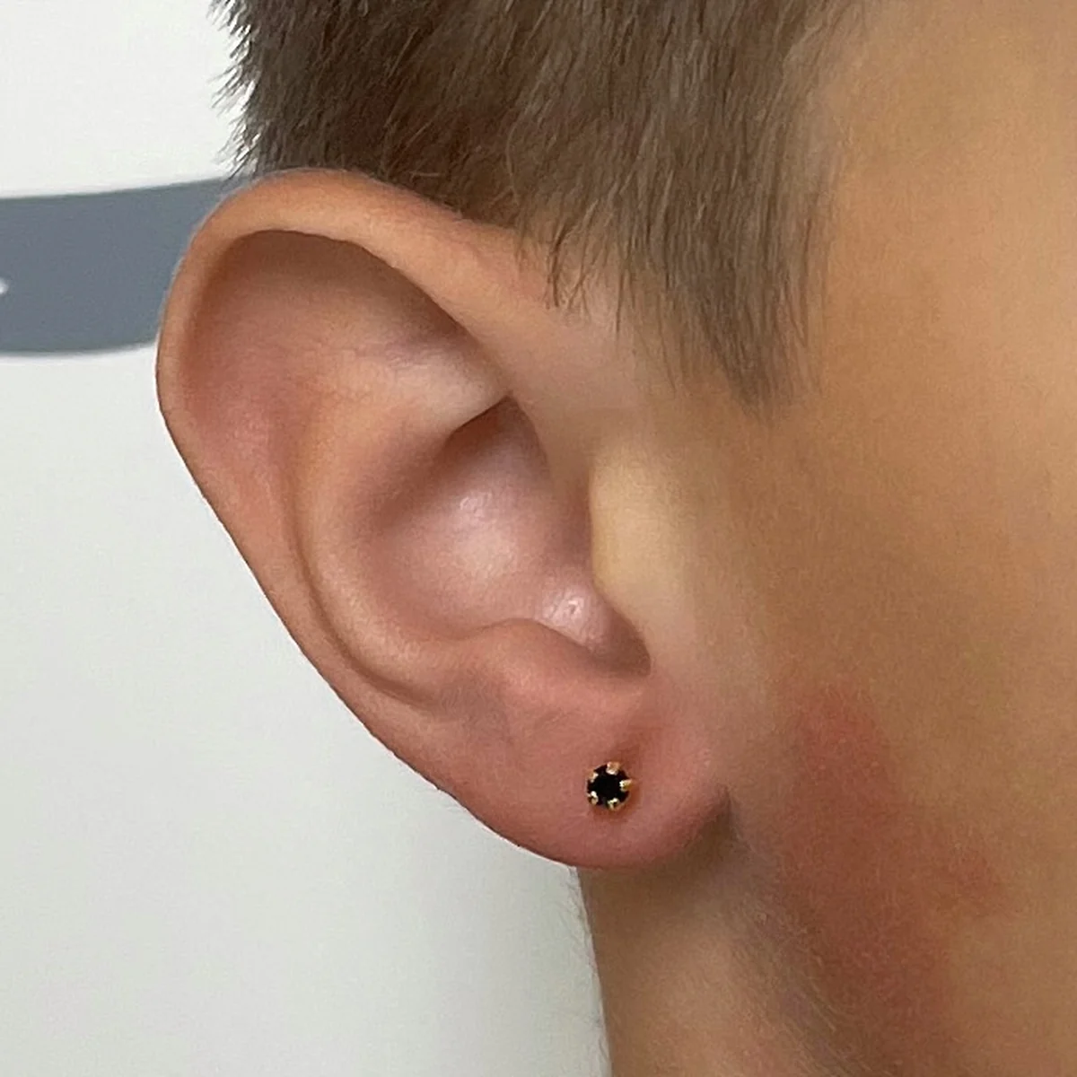 Dětské ucho s černou kamínkovou náušnicí po nastřelení